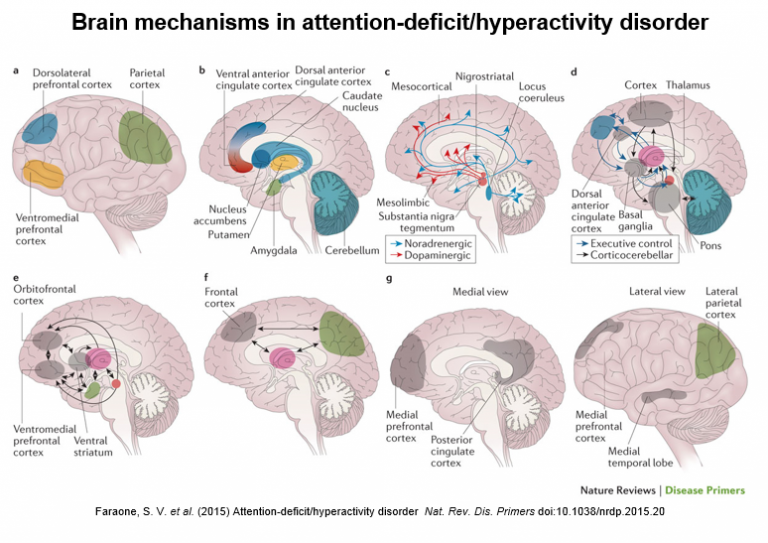 Eight Pictures Describe Brain Mechanisms In ADHD | APSARD